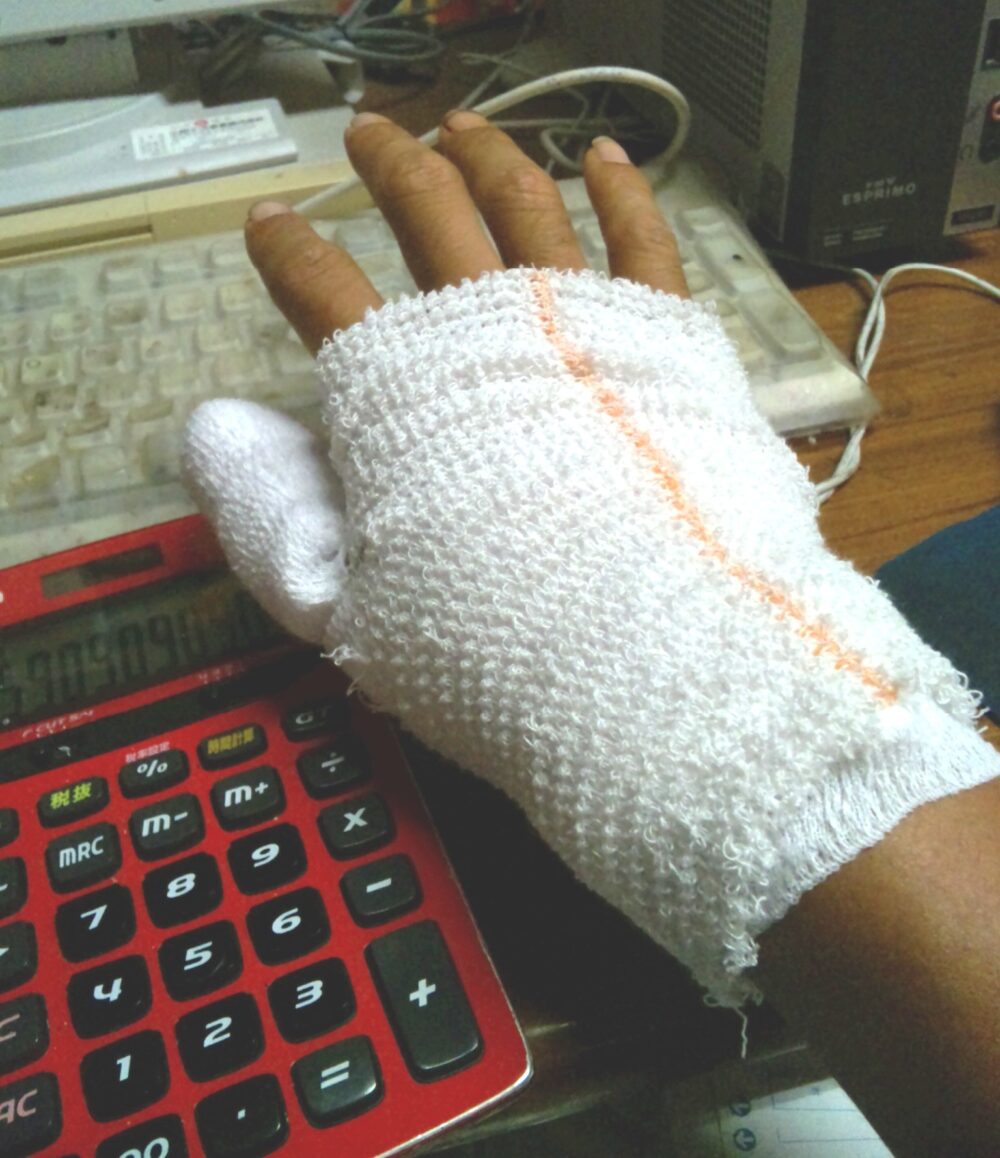 包帯を巻いて手